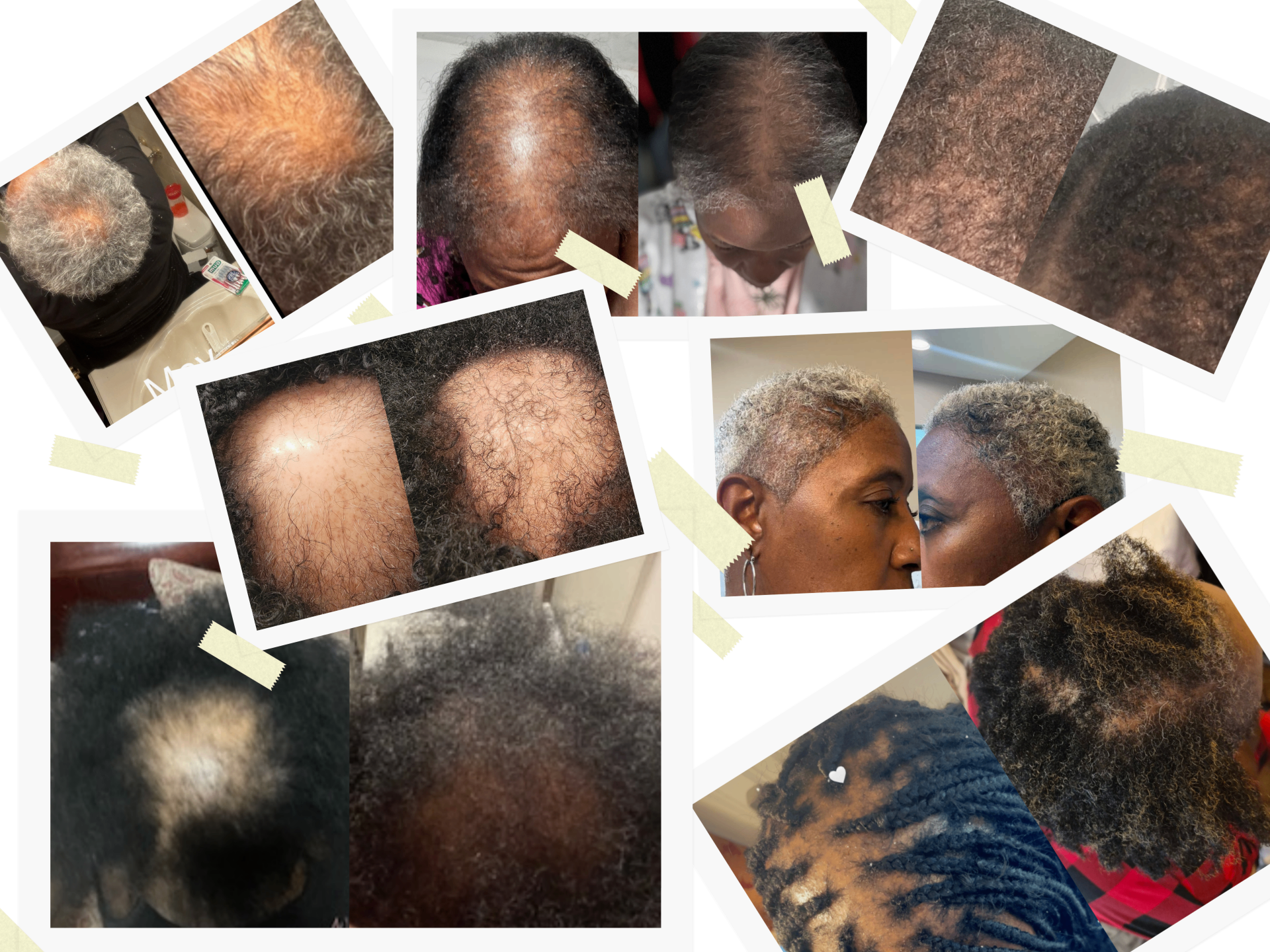 Real women hair growth results collage